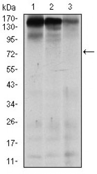 MSH6 Primary Antibody MP30283 [M5B11]