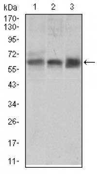 BMPR1A Primary Antibody MP30446A [M4B7B2]