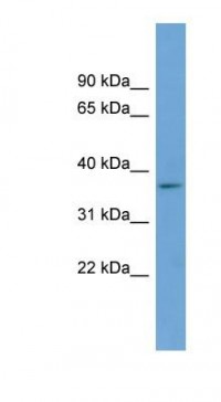 Anti-BACE2 Antibody (aa287-336, HRP) MX-C449359