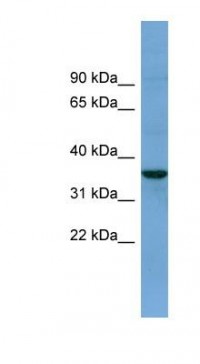 Anti-BACE2 Antibody (aa71-120, FITC) MX-C449360