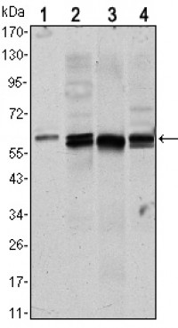 AKT1 Primary Antibody MP20434 [M3A3]