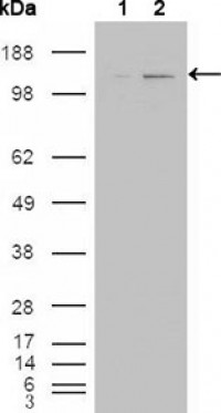 ABL2 Primary Antibody MP20429 [M1H1]