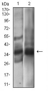 EPCAM Primary Antibody MP30630 [M7B5C10]