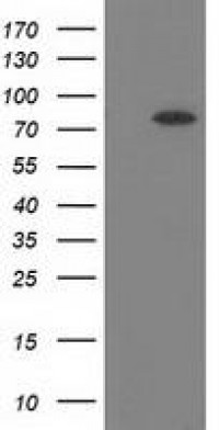 Anti-BCHE / Cholinesterase Antibody (clone 4C12) MX-C172572