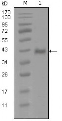 AR Primary Antibody MP20273 [M1A9D12]