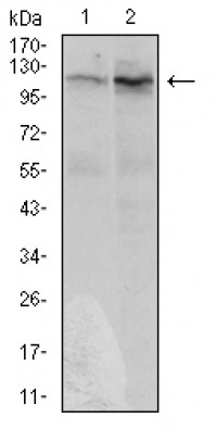 DIS3L2 Primary Antibody MP30562 [M6C7B2]