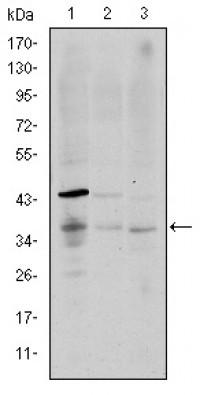 CD1A Primary Antibody MP30185 [M6H3]