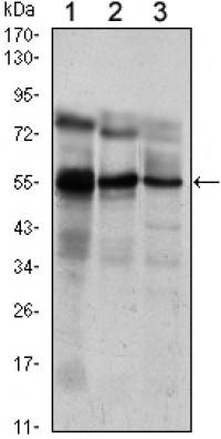 ETV5 Primary Antibody MP30055 [M3H3]