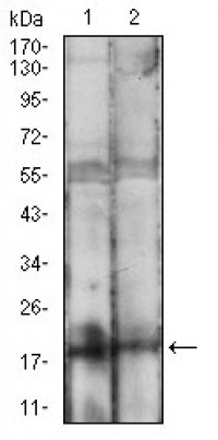 BAD Primary Antibody MP30637 [M1G5B3]