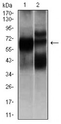 HEXA Primary Antibody MP30343 [M3F10]