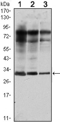 Rab25 Primary Antibody MP20430 [M3F12]