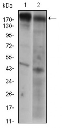 EGFR Primary Antibody MP30552 [M7A6F12]