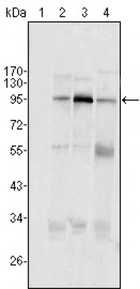 SND1/P100 Primary Antibody MP20229 [M2D7]