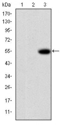 MMP9 Primary Antibody MP30251 [M5G3]