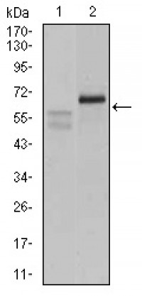 CA9 Primary Antibody MP30545 [M7C4A5]