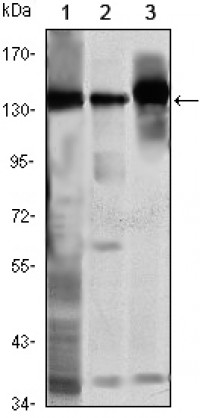 SMC1 Primary Antibody MP20426 [M5B6]