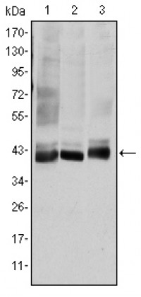 MAP2K4 Primary Antibody MP30168 [M5H4]