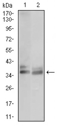 ACP5 Primary Antibody MP30508 [M5C5E7]