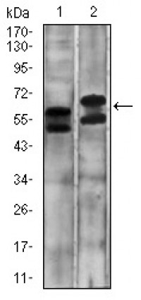 CA9 Primary Antibody MP30544 [M10F7A8]