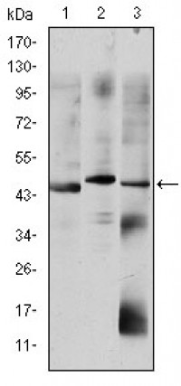 OTX2 Primary Antibody MP30217 [M1H12C4B5]