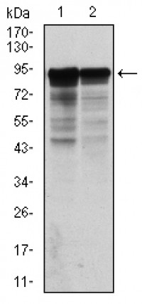 NEFL Primary Antibody MP30310 [M1H3]