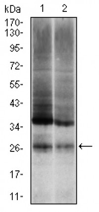 UBB Primary Antibody MP30317 [M3C12]