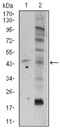 FZD5 Primary Antibody MP30412 [M2D12]