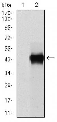 SERPINE1 Primary Antibody MP30306 [M1D5]