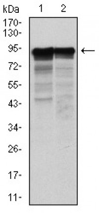 NEFL Primary Antibody MP30313 [M2G10]