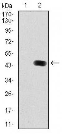 MAP1LC3B Primary Antibody MP30363 [M5H12]