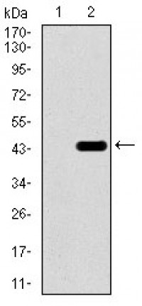T Primary Antibody MP30385 [M6C12]