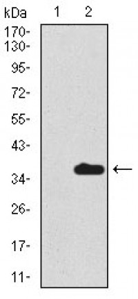 SCGB1A1 Primary Antibody MP30425 [M3A8B8]