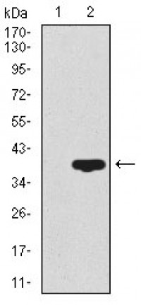 CD59 Primary Antibody MP30428 [M8D2B8]