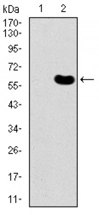 DKK3 Primary Antibody MP30436 [M8A5C6]