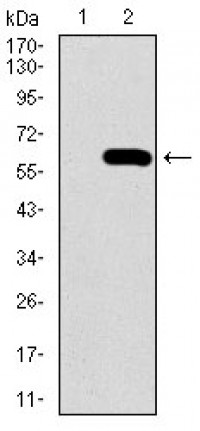 SPP1 Primary Antibody MP30443 [M7C5H12]
