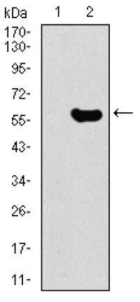 GNL3 Primary Antibody MP30458A [M2C8D5]
