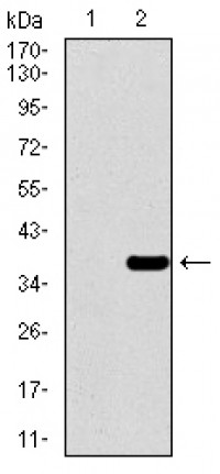 PAX3 Primary Antibody MP30482P  [M7D8G7]