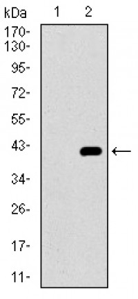 ITGA2B Primary Antibody MP30485A  [M2E10C9]