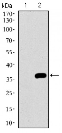 NRCAM Primary Antibody MP30490 [M7D8C5]
