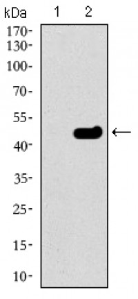 TUBB2A Primary Antibody MP30493 [M6A10B2]