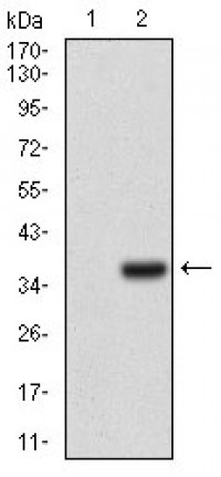 IL3RA Primary Antibody MP30527 [M10B8E7]