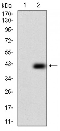 PLAGL1 Primary Antibody MP30530 [M8D8C5]