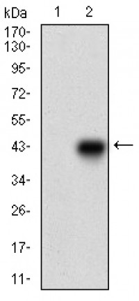 ONECUT3 Primary Antibody MP30533 [M7D4G10]