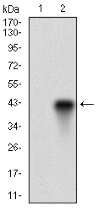 FUT4 Primary Antibody MP30535 [M6B11B4]