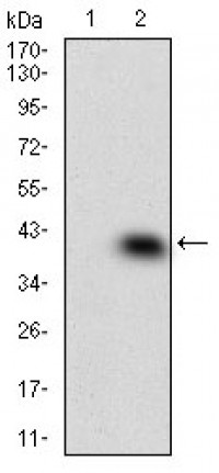 MAPK14 Primary Antibody MP30566 [M10B11C8]