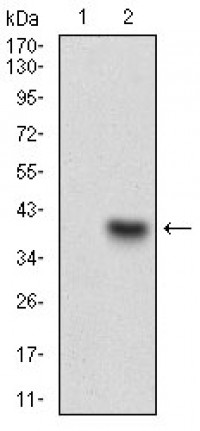 CD93 Primary Antibody MP30568 [M2F7D11]