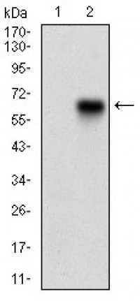 CAMK2G Primary Antibody  MP30617T [M6A4A10]
