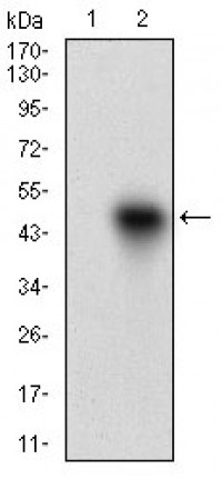 ROR2 Primary Antibody MP30623T [M6F2D10]