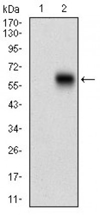 CAMK2G Primary Antibody MP30624T  [M8G10C1]