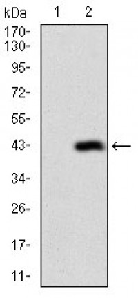 DSG3 Primary Antibody  MP30627T [M6G2C11]